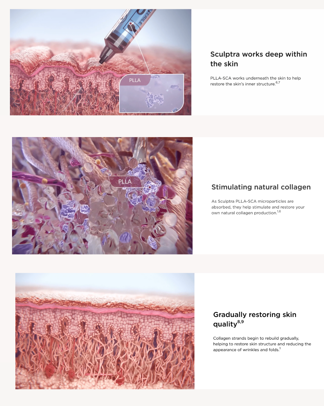 How Sculptra works to stimulate collagen production